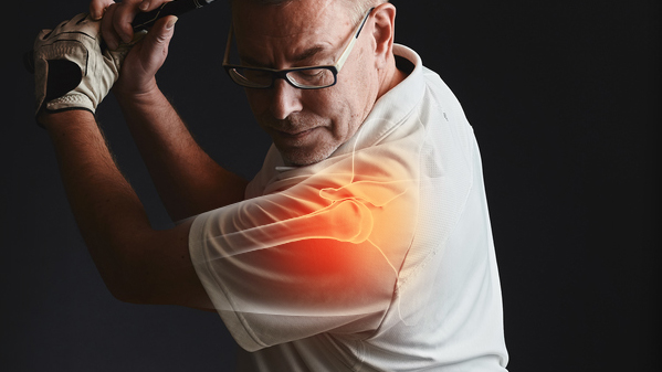 Rotator cuff
repair 